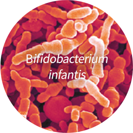 Bifidobacterium infantis